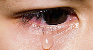 流淚畏光為先天性青光眼症狀表現