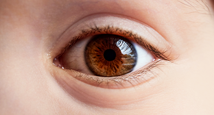 角膜水腫為先天性青光眼症狀表現