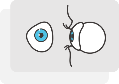義眼移植為眼整形方案