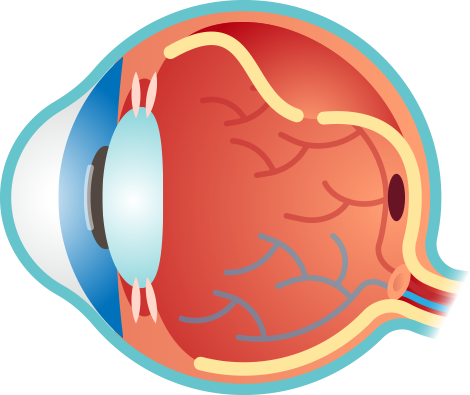 視網膜脫落眼睛結構