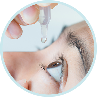 使用阿托品眼藥水控制近視的患者