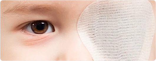 兒童進行遮眼治療的斜視矯正方法