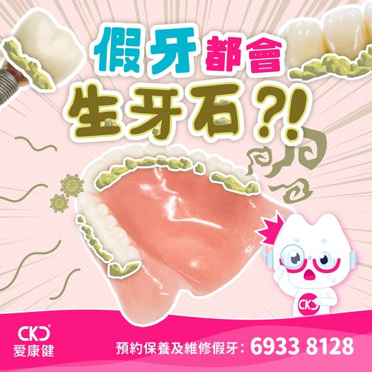假牙都會生牙石?!