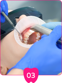 使用先進的3D掃描技術，獲得精確的牙齒和口腔結構數據。取得牙齒的模型，以便製作合適的牙冠。