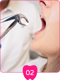 牙醫將進行治療牙齒，移除受損或蛀牙部分，為牙冠安裝作準備。