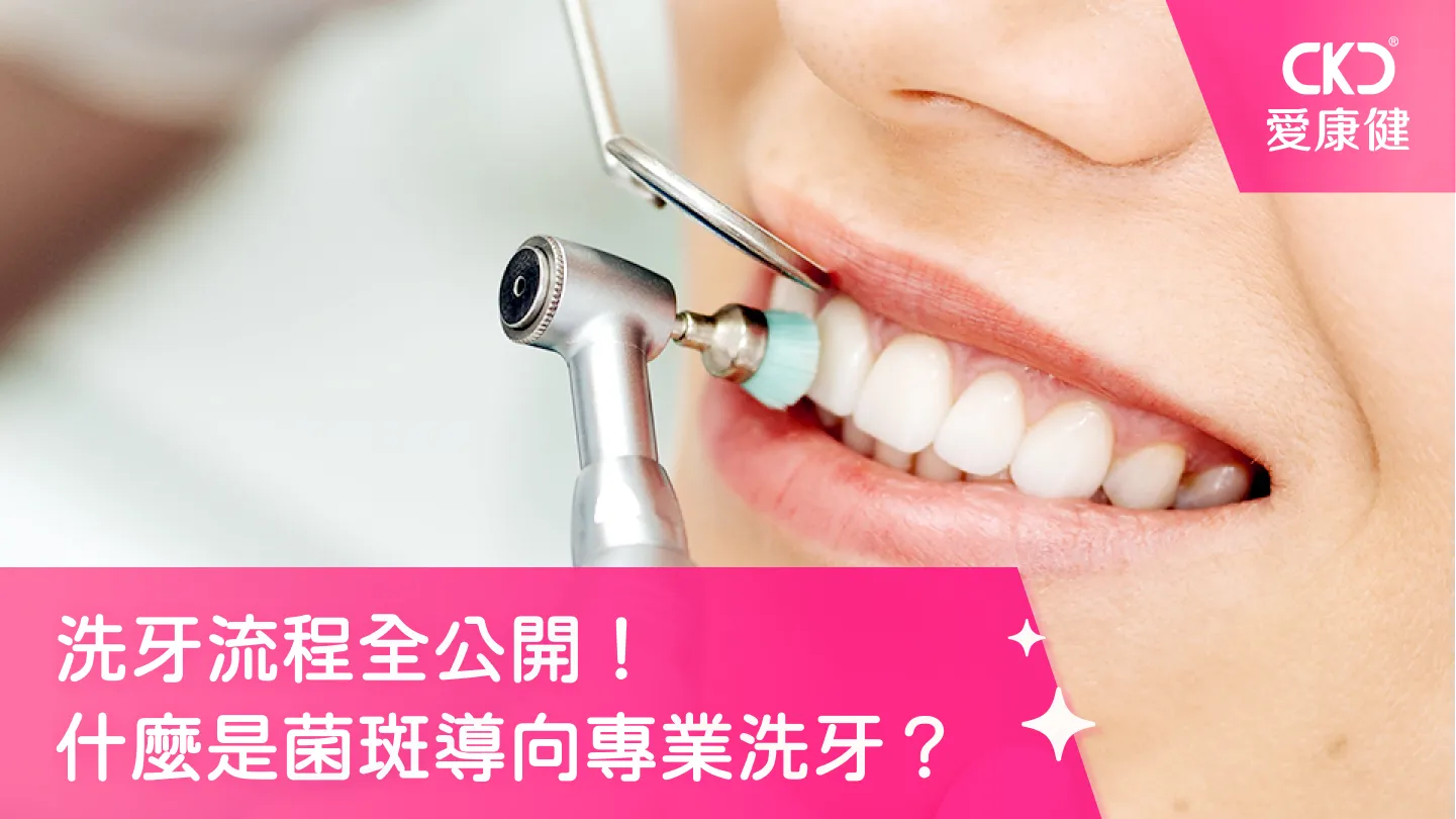 洗牙流程全公開！什麼是菌斑導向專業洗牙？