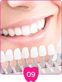 以牙齒專用色階進行對色，比對療程前後效果