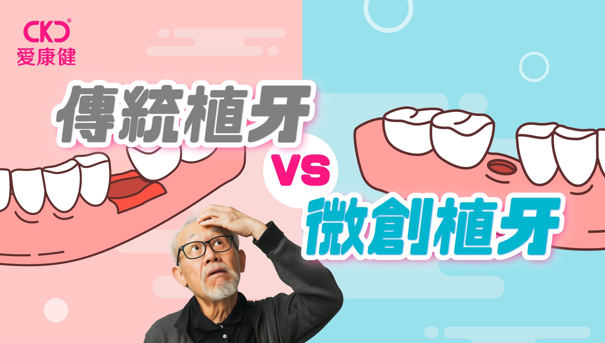 【傳統植牙 🆚 微創植牙】📣技術提升唔需要開刀