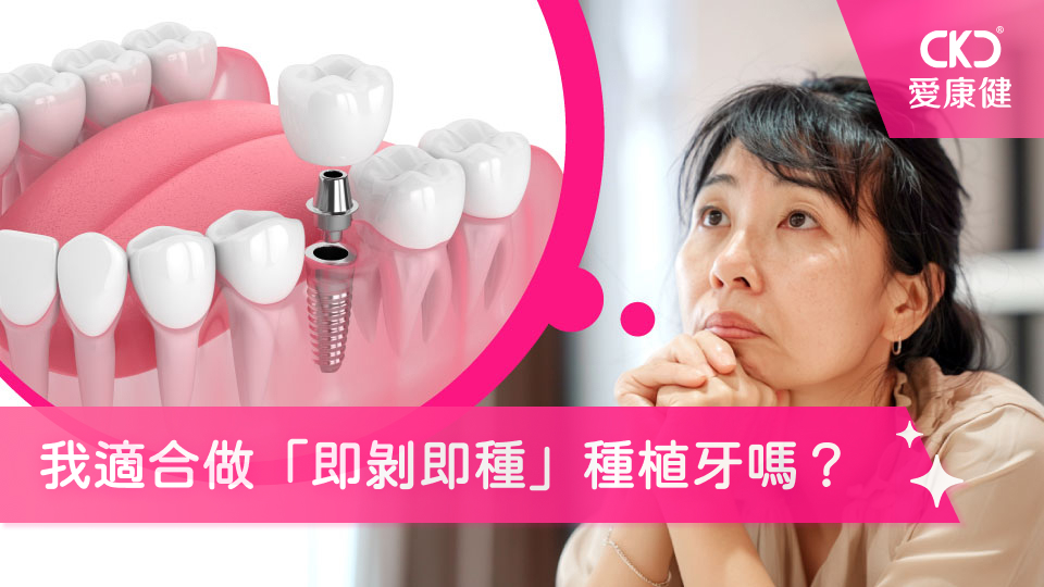 我適合做「即剝即種」種植牙嗎？