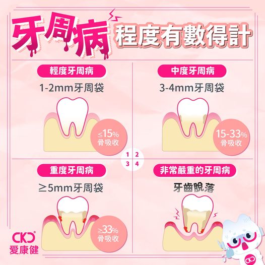 牙周病程度有數得計
