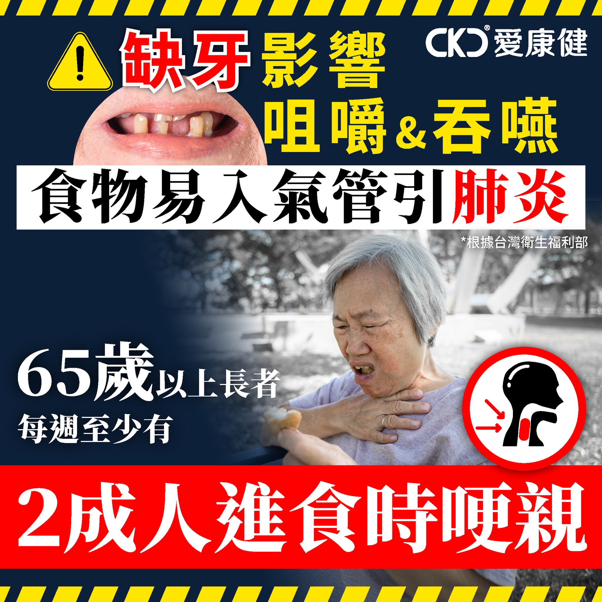 缺牙影響咀嚼和吞嚥功能，食物易誤入氣管引發肺炎
