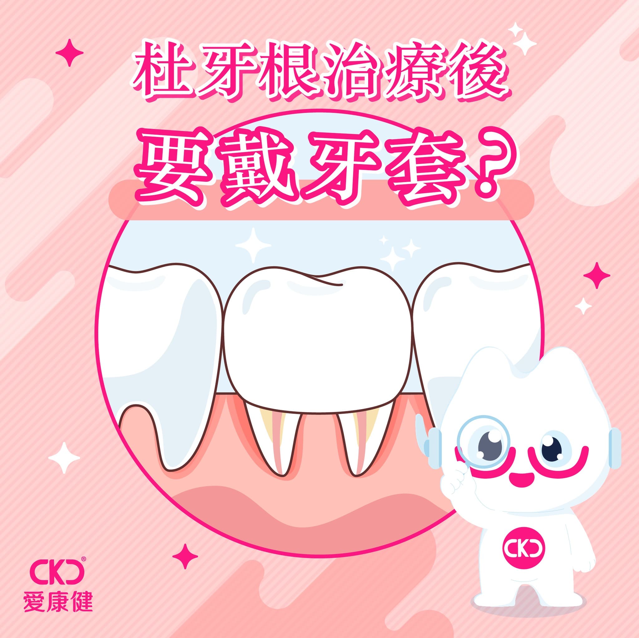 杜牙根治療後要戴牙套？