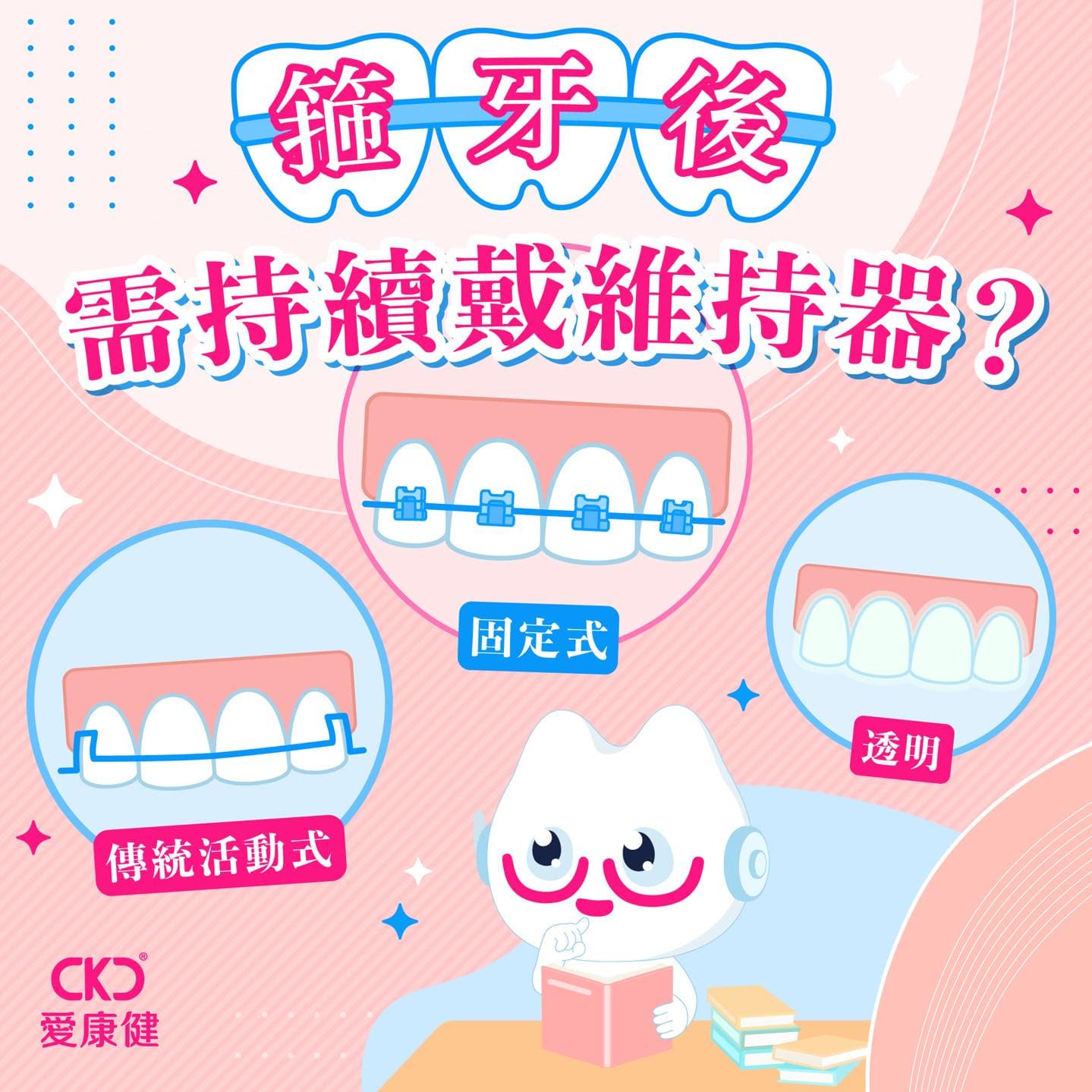 箍牙後需持續戴維持器？