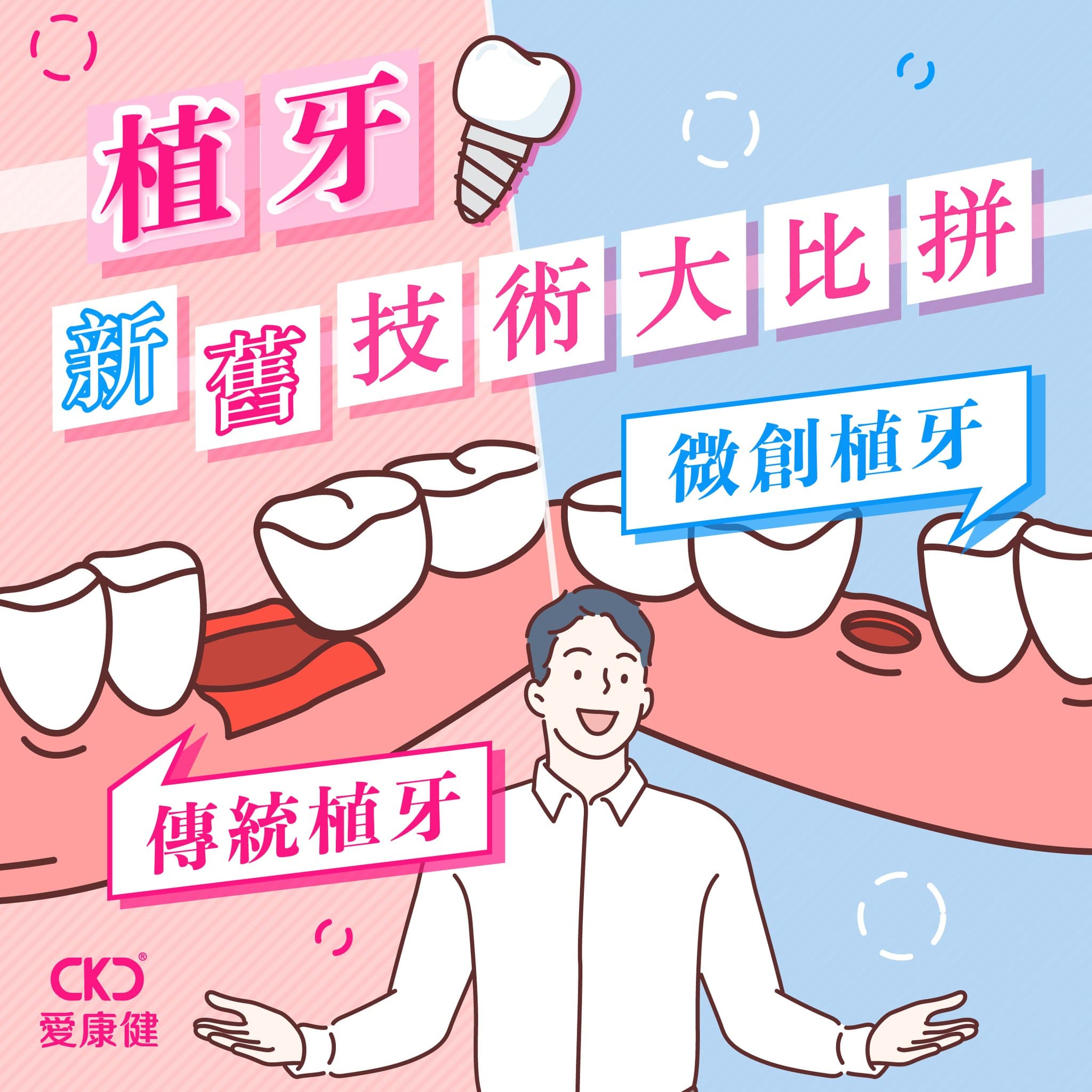 植牙新舊技術大比拼