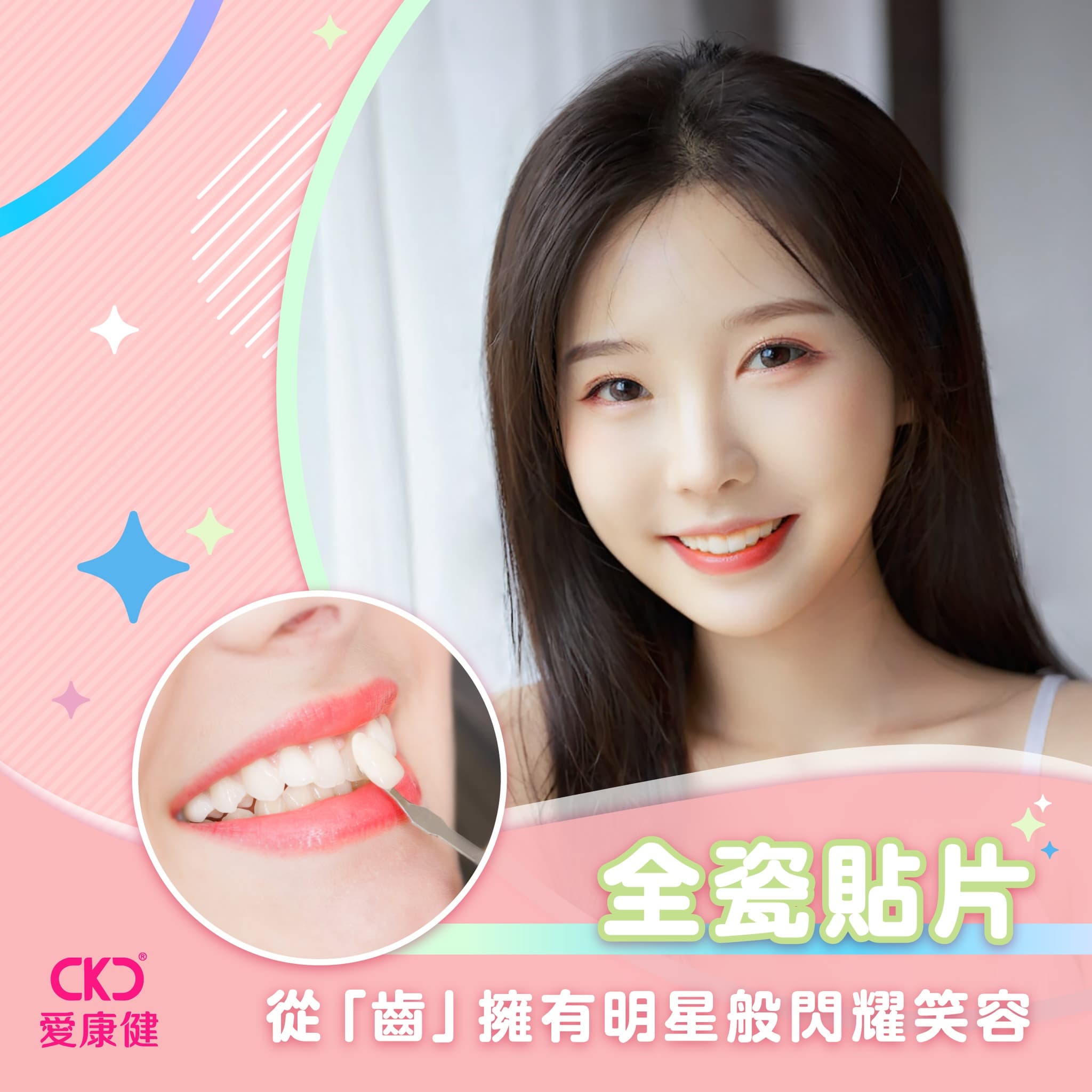 【2024全瓷貼面✨】從「齒」擁有明星般閃耀笑容
