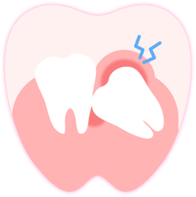 牙齦炎和感染